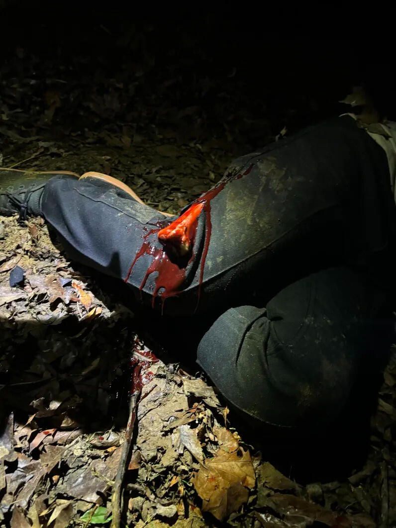 Night scenario: a simulated leg wound lit by a headlamp